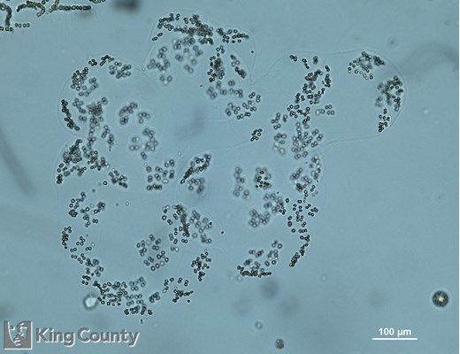 Photo of Phaeocystis sp.